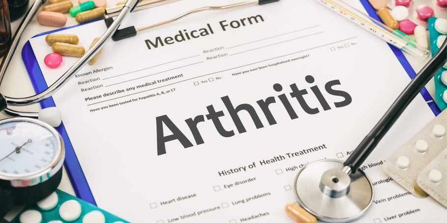 Can CBD Help My Arthritis?