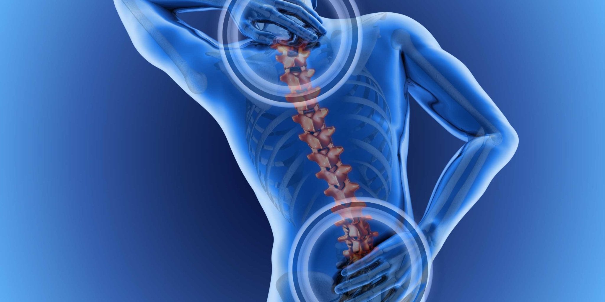 CBD and Back Pain - Associated CBD
